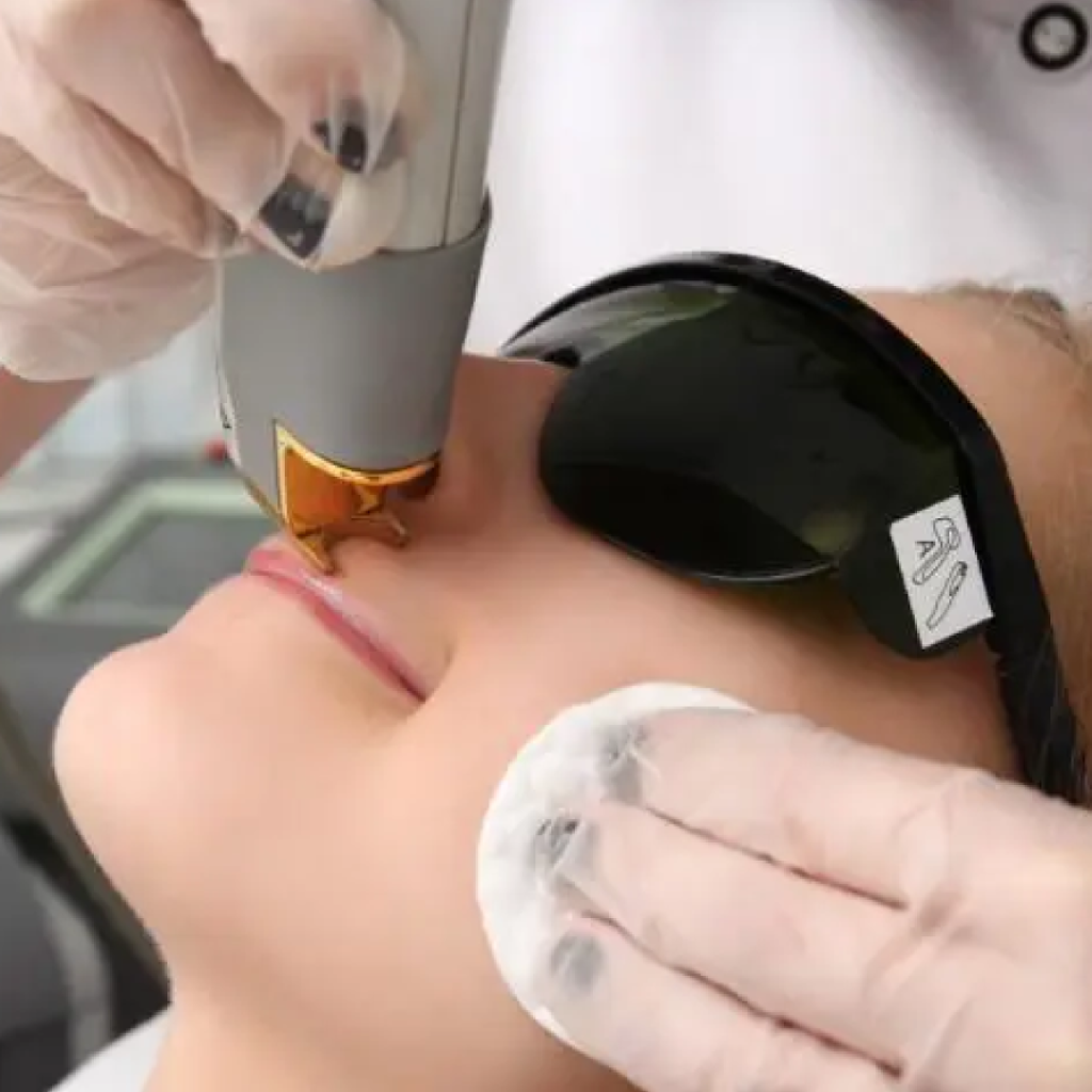 Vanc over laser hair removal