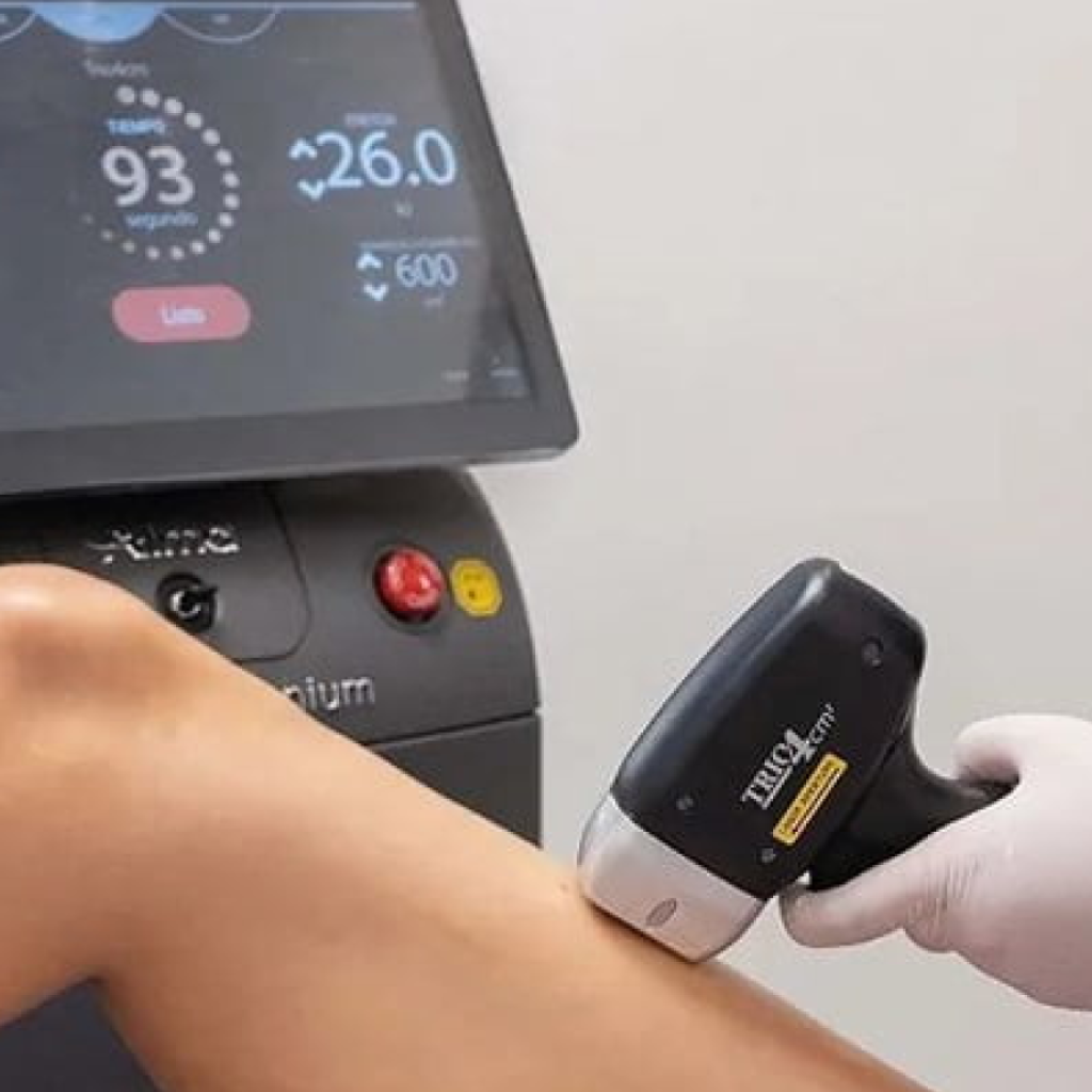 Surrey laser hair removal